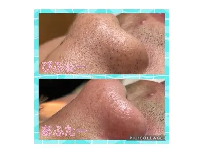 total skincare 美容Room (旧No.7) 【ビヨウルーム】/ ピーリング 脱毛 痩身 / 町田 - 5