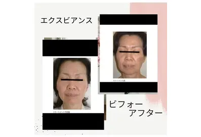total skincare 美容Room (旧No.7) 【ビヨウルーム】/ ピーリング 脱毛 痩身 / 町田 - 6