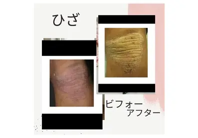 total skincare 美容Room (旧No.7) 【ビヨウルーム】/ ピーリング 脱毛 痩身 / 町田 - 7