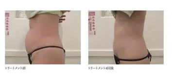 total skincare 美容Room (旧No.7) 【ビヨウルーム】/ ピーリング 脱毛 痩身 / 町田 - 13
