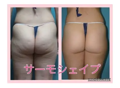 total skincare 美容Room (旧No.7) 【ビヨウルーム】/ ピーリング 脱毛 痩身 / 町田 - 14