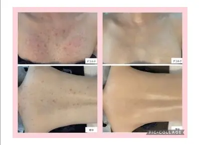 total skincare 美容Room (旧No.7) 【ビヨウルーム】/ ピーリング 脱毛 痩身 / 町田 - 15