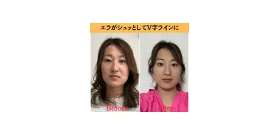 小顔＆美容整体サロン シルフィード/ 小顔矯正,美容整体 / 渋沢