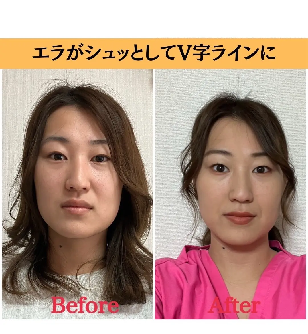 小顔＆美容整体サロン シルフィード/ 小顔矯正,美容整体 / 渋沢 - 2