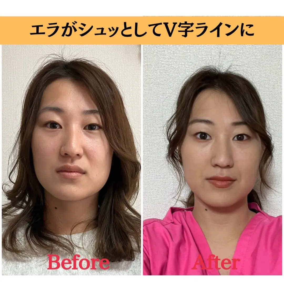 小顔＆美容整体サロン シルフィード/ 小顔矯正,美容整体 / 渋沢 - 3