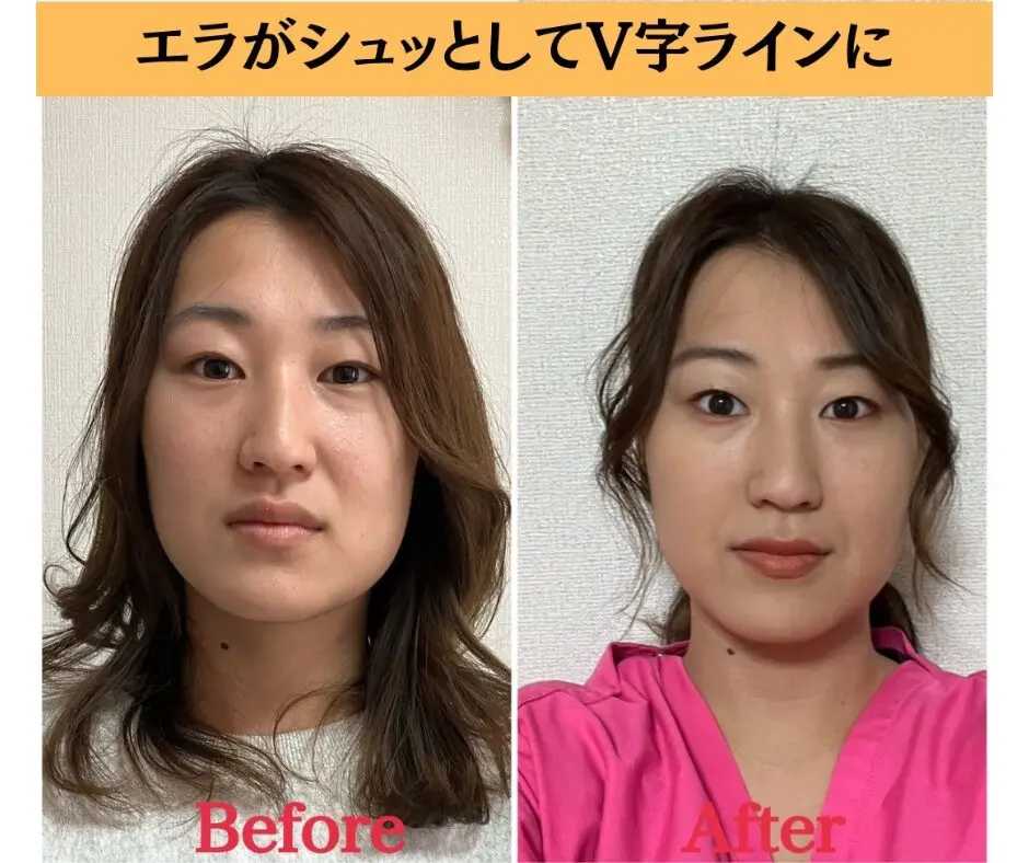 小顔＆美容整体サロン シルフィード/ 小顔矯正,美容整体 / 渋沢 - 4