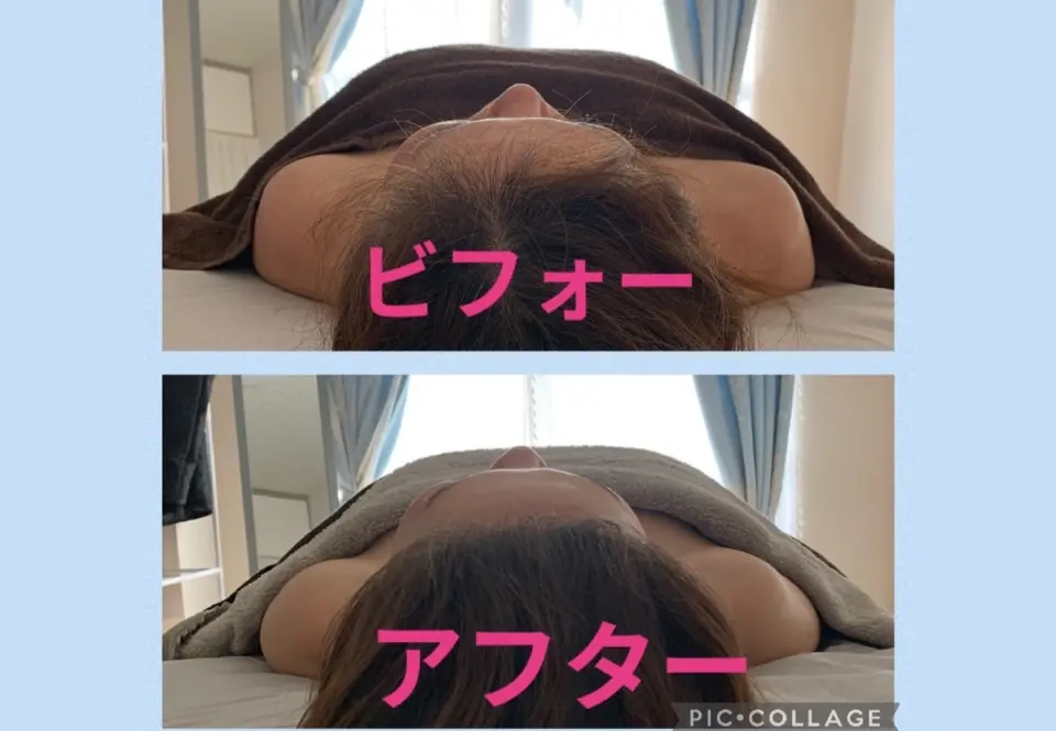 Circle-on【サークルオン】/ 筋膜リリース トリムリターン / 西大寺 - 9
