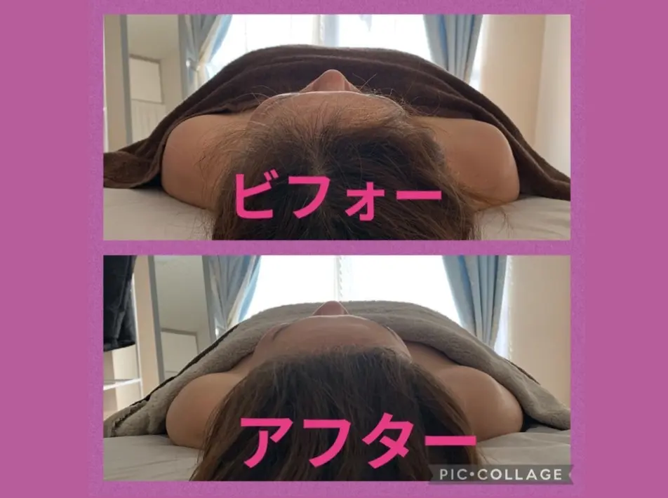 Circle-on【サークルオン】/ 筋膜リリース トリムリターン / 西大寺 - 13