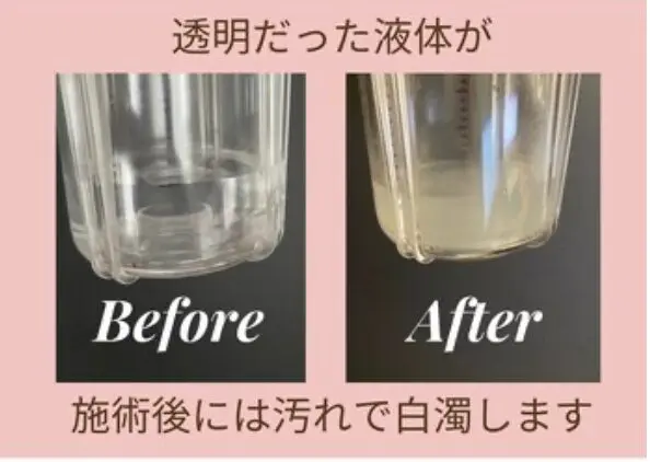 Festina Lente 【フェスティナ レンテ】/ 毛穴洗浄サロン / 学芸大