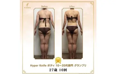Salon Riem.【サロンリエム】/ よもぎ蒸し・ハーブピーリング・痩身 / 土浦 - 11