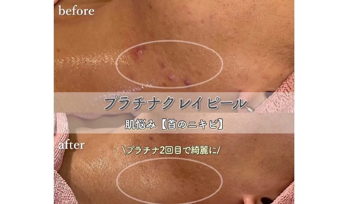 Jubile.39【ジュビリー】/ 肌質・体質改善 美肌ダイエット/ 東浦和 - 2