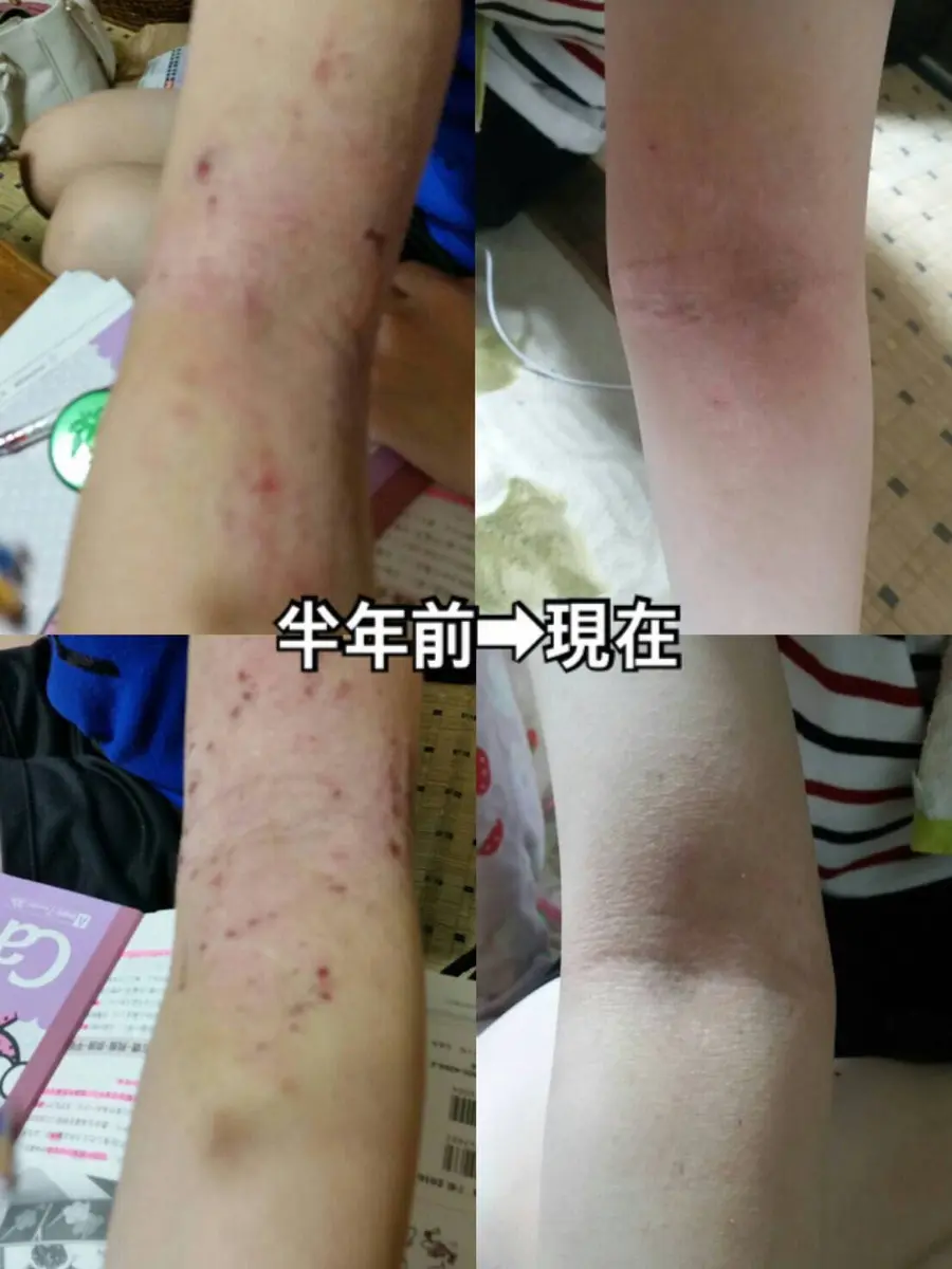 心〜こころ〜 / アトピー ダイエット 体質改善整体 / 福岡 - 9