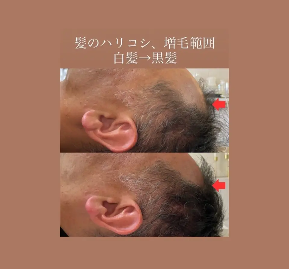 SHIFA beauty salon【シファビューティサロン】/ 真の体質改善 / つくば市 - 13