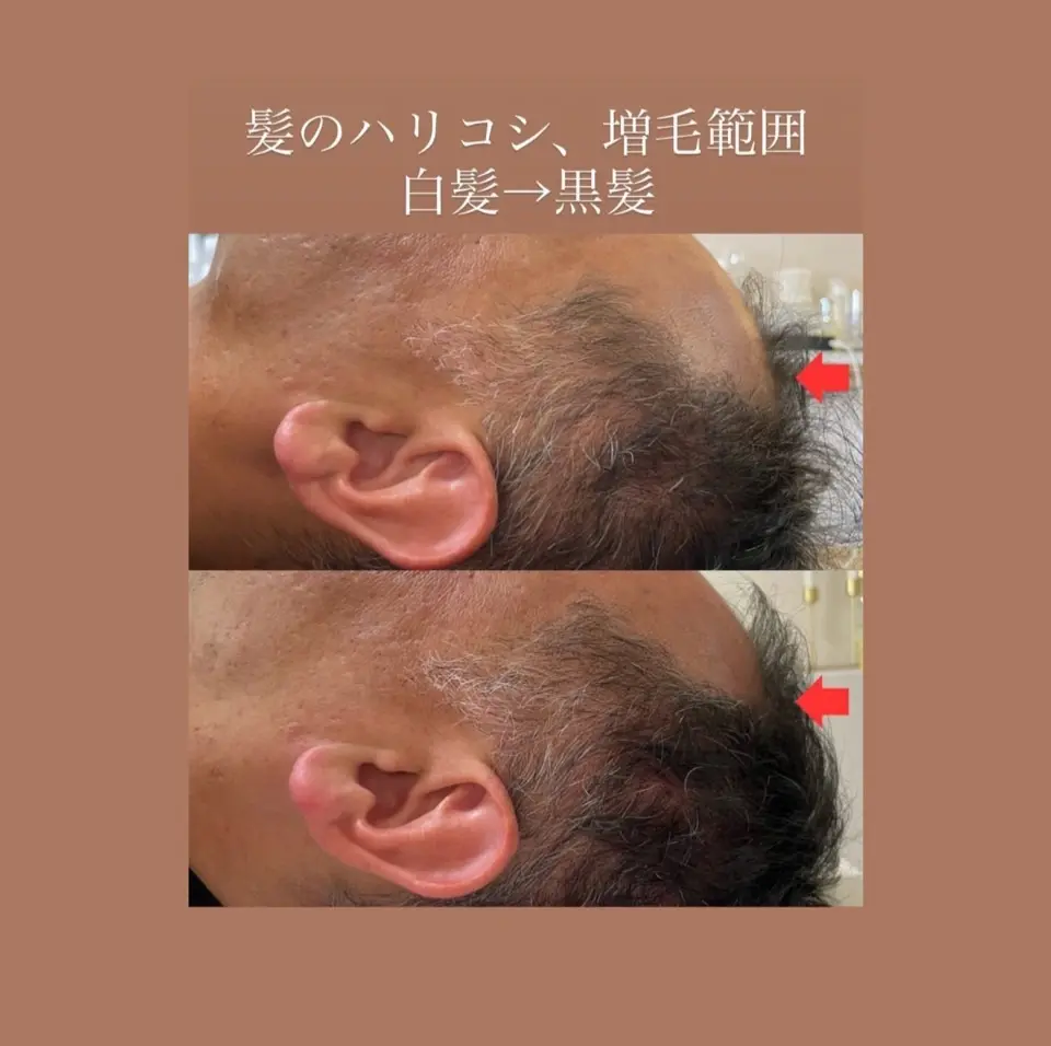 SHIFA beauty salon【シファビューティサロン】/ 真の体質改善 / つくば市 - 14