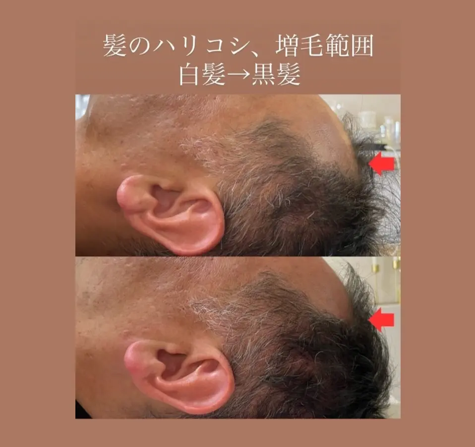 SHIFA beauty salon【シファビューティサロン】/ 真の体質改善 / つくば市 - 15