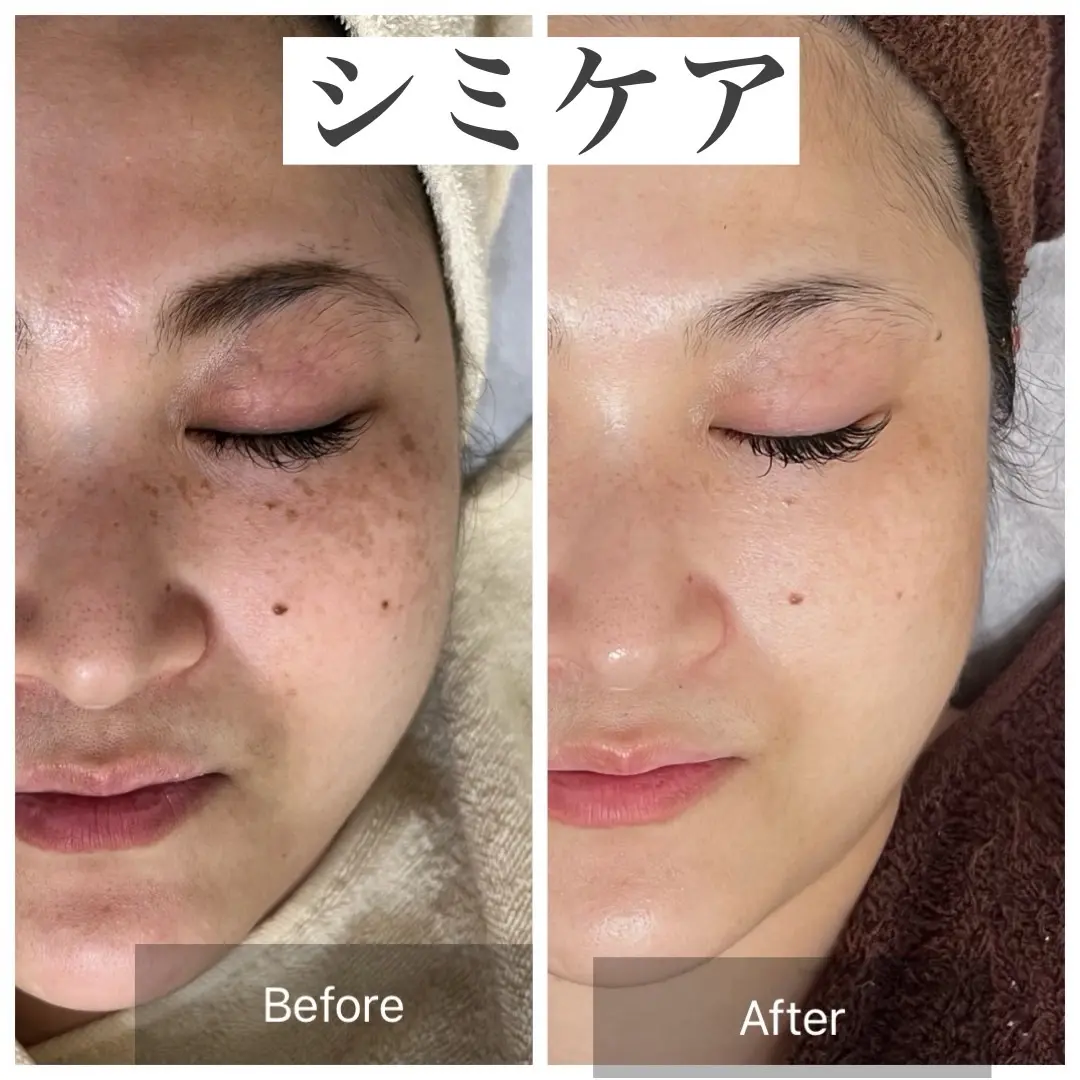 K beauty【ケービューティー】/ 脳洗浄•体質ケア / 熊本藤崎宮 - 2