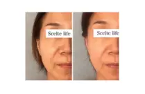 Scelte life【シェルテライフ】/ アロマリンパマッサージ ハーブピーリング / 名古屋市北区 春日井 - 6