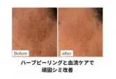Scelte life【シェルテライフ】/ アロマリンパマッサージ ハーブピーリング / 名古屋市北区 春日井 - 7