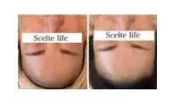 Scelte life【シェルテライフ】/ アロマリンパマッサージ ハーブピーリング / 名古屋市北区 春日井 - 8