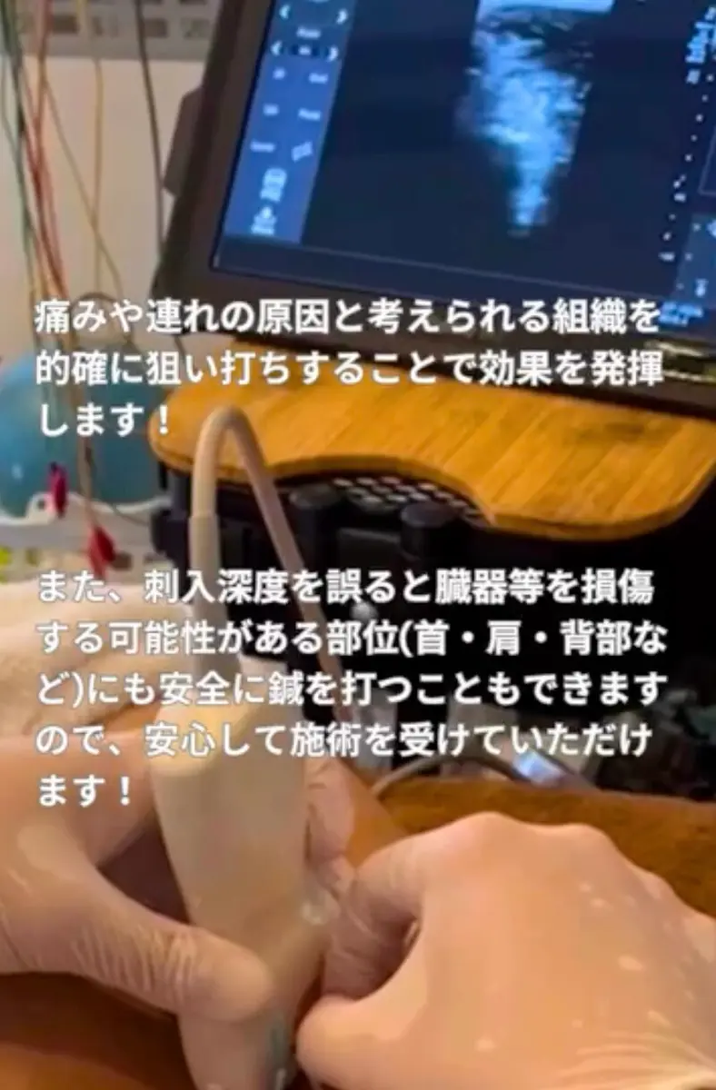 日吉アキュートメント鍼灸治療院 / 快眠鍼 エコーガイド下鍼灸治療 / 横浜日吉 - 8