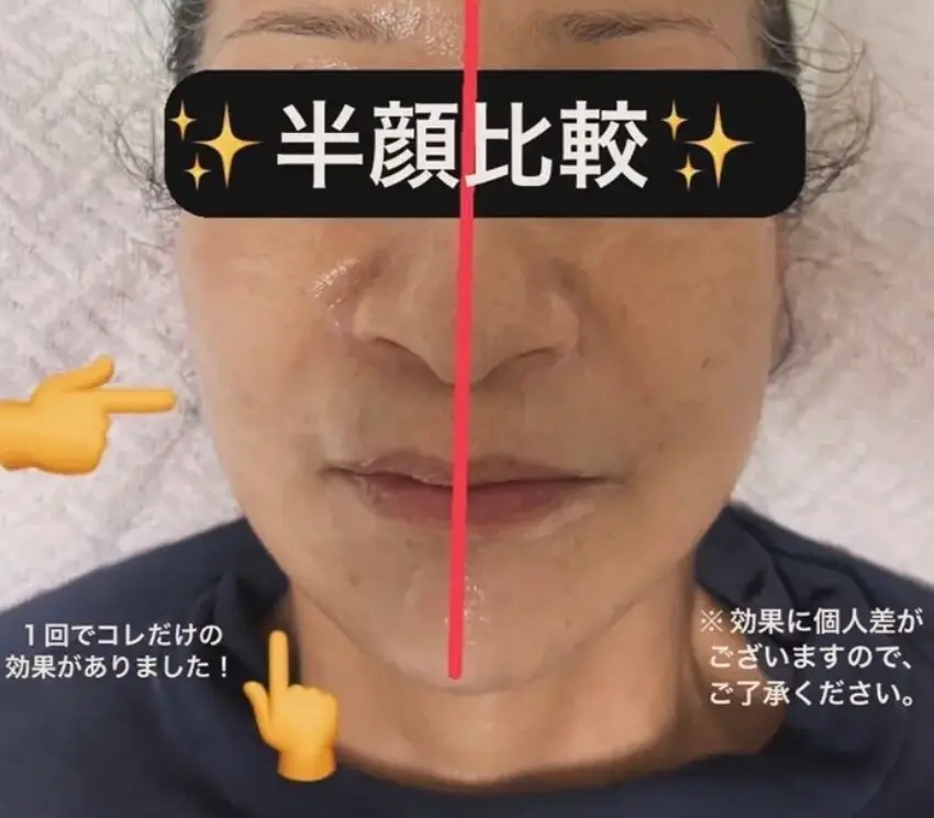 TwinQle Beauty【トゥインクル ビューティー】/ アンチエイジングフェイシャル / 上野 池袋 船堀 - 10