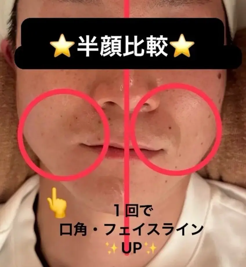 TwinQle Beauty【トゥインクル ビューティー】/ アンチエイジングフェイシャル / 上野 池袋 船堀 - 11